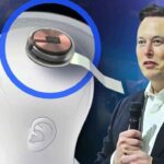 Elon Musk’s Neuralink Telepathy: Miracle Happened! ‘Chip’ In Human Brain